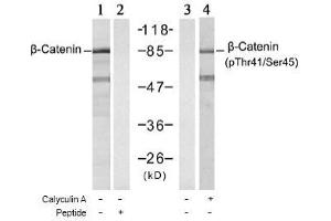 Image no. 1 for anti-Catenin (Cadherin-Associated Protein), beta 1, 88kDa (CTNNB1) (Ser45), (Thr41) antibody (ABIN197275)