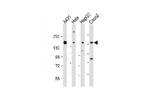 All lanes : Anti-CCK4 (PTK7) Antibody (N-term) at 1:1000-1:2000 dilution Lane 1: A431 whole cell lysate Lane 2: Hela whole cell lysate Lane 3: HepG2 whole cell lysate Lane 4: Caco2 whole cell lysate Lysates/proteins at 20 μg per lane.