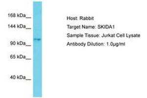 Image no. 1 for anti-SKI/DACH Domain Containing 1 (SKIDA1) (AA 772-821) antibody (ABIN6750805) (SKIDA1 anticorps  (AA 772-821))