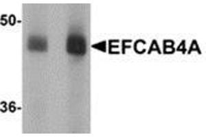 Western blot analysis of EFCAB4A in human lung tissue lysate with EFCAB4A antibody at (A) 1 and (B) 2 μg/ml. (EFCAB4A anticorps  (Center))