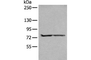 Western blot analysis of A549 and Jurkat cell lysates using ALKBH8 Polyclonal Antibody at dilution of 1:300 (ALKBH8 anticorps)