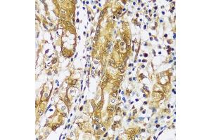 Immunohistochemistry of paraffin-embedded human stomach using CAST antibody  at dilution of 1:100 (40x lens).