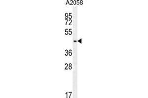 WDR21C Antibody (N-term) western blot analysis in A2058 cell line lysates (35 µg/lane).