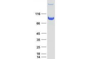 Validation with Western Blot