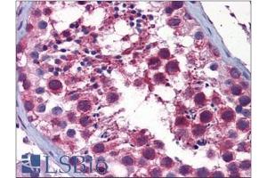 Immunohistochemistry (IHC) image for anti-serine/threonine Kinase 38 (STK38) (AA 365-466) antibody (ABIN954986)