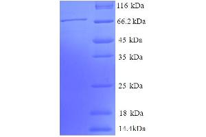 SDS-PAGE (SDS) image for Phosphoglycerate Kinase 1 (PGK1) (AA 25-417), (partial) protein (GST tag) (ABIN5712027) (PGK1 Protein (AA 25-417, partial) (GST tag))