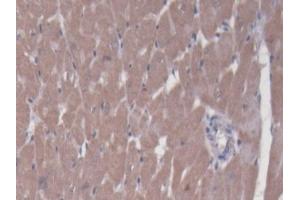 DAB staining on IHC-P; Samples: Rat Heart Tissue (BCAT1 anticorps  (AA 179-411))