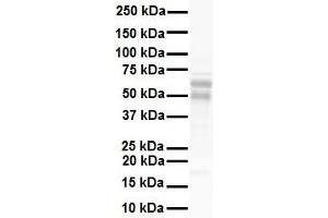 WB Suggested Anti-NR5A1 antibody Titration: 1 ug/mL Sample Type: Human heart