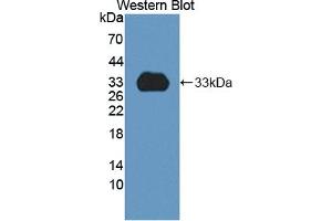 Detection of Recombinant CYP1A2, Rat using Polyclonal Antibody to Cytochrome P450 1A2 (CYP1A2) (CYP1A2 anticorps  (AA 192-444))