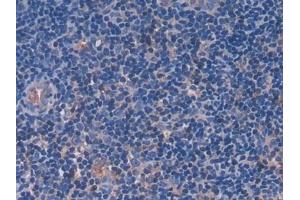 Detection of FGL1 in Rat Lymph node Tissue using Polyclonal Antibody to Fibrinogen Like Protein 1 (FGL1)