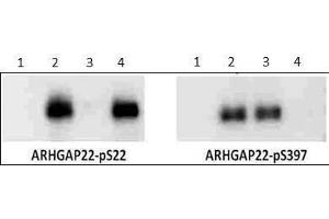 Western Blot of Rabbit anti-ARHGAP22 pS397 antibody.