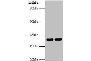 Western blot All lanes: HLA-DRB1 antibody at 2 μg/mL Lane 1: A375 whole cell lysate Lane 2: Raji whole cell lysate Secondary Goat polyclonal to rabbit IgG at 1/10000 dilution Predicted band size: 30 kDa Observed band size: 30 kDa