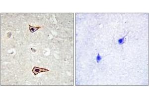 Immunohistochemistry analysis of paraffin-embedded human brain, using Kv1.