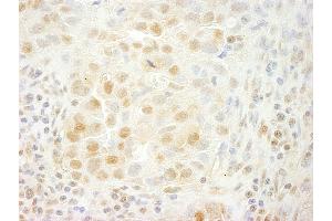 Immunohistochemistry (IHC) image for anti-Serine/threonine-Protein Kinase PRP4 Homolog (PRPF4B) (AA 1-50) antibody (ABIN7454536)