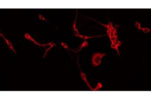 ABIN6266565 staining Hela by IF/ICC. (Integrin beta 5 anticorps  (C-Term))