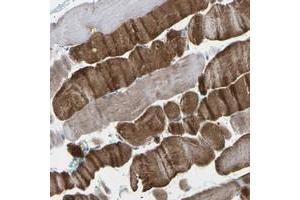 Immunohistochemical staining of human skeletal muscle with TMCO4 polyclonal antibody  shows strong cytoplasmic positivity in myocytes at 1:200-1:500 dilution. (TMCO4 anticorps)