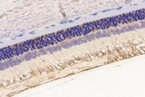 Immunohistochemistry analysis of paraffin-embedded rat eyeball using,KCNV2 (ABIN7075150) at dilution of 1: 2800 (KCNV2 anticorps)