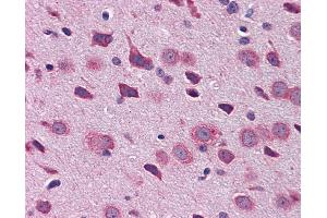 Immunohistochemistry (IHC) image for anti-T-Box Brain Gene 1 (TBR1) (N-Term) antibody (ABIN2779899)