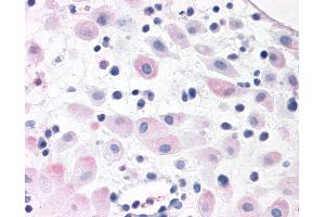 Anti-BRS3 antibody IHC of human pregnant uterus. (BRS3 anticorps  (N-Term))