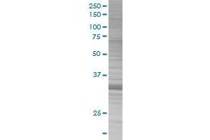 ING2 transfected lysate. (ING2 293T Cell Transient Overexpression Lysate(Denatured))