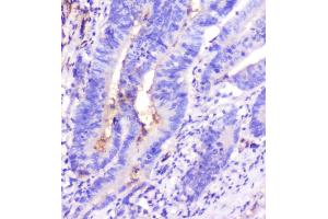 IHC analysis of ADA using anti-ADA antibody (ABIN6719272). (ADA anticorps  (AA 135-363))