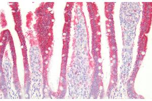 anti-Mercaptopyruvate Sulfurtransferase (MPST) (AA 68-278) antibody