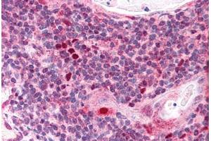 Human Thymus (formalin-fixed, paraffin-embedded) stained with AIRE antibody ABIN291034 at 2. (AIRE anticorps  (AA 534-545))