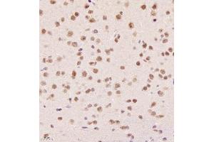 Immunohistochemistry of paraffin embedded mouse brain using SR140 (ABIN7076091) at dilution of 1:1000 (400x lens) (SR140 anticorps)