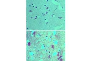 Image no. 1 for anti-SRY (Sex Determining Region Y)-Box 1 (SOX1) (AA 100-150) antibody (ABIN960348)