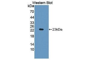 Western Blotting (WB) image for anti-Indoleamine 2,3-Dioxygenase (IDO) (AA 26-199) antibody (ABIN1868485) (IDO anticorps  (AA 26-199))