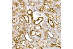 Immunohistochemistry of paraffin-embedded rat kidney using KLK1 Rabbit pAb (ABIN3022581, ABIN3022582, ABIN3022583 and ABIN6218920) at dilution of 1:500 (40x lens).