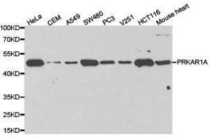 Western Blotting (WB) image for anti-Protein Kinase, CAMP-Dependent, Regulatory, Type I, alpha (Tissue Specific Extinguisher 1) (PRKAR1A) antibody (ABIN1874285) (PRKAR1A anticorps)