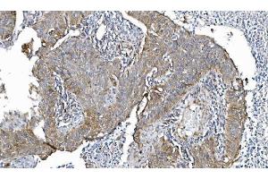 IHC analysis of POR using anti-POR antibody (ABIN7602795).
