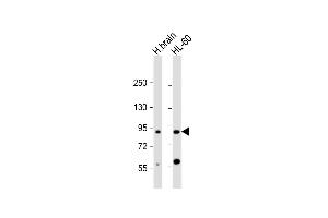 All lanes : Anti-CCDC144A Antibody (C-Term) at 1:2000 dilution Lane 1: human brain lysate Lane 2: HL-60 whole cell lysate Lysates/proteins at 20 μg per lane. (CCDC144A anticorps  (AA 1257-1289))
