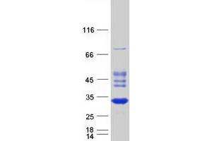 Validation with Western Blot