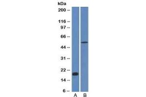 Western blot analysis A) partial recombinant protein B) human stomach lysate using E-Cadherin antibody (CDH1/1525). (E-cadherin anticorps)