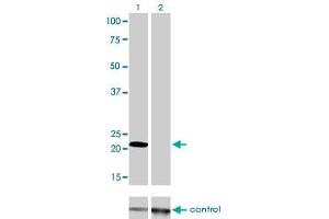 Western blot analysis of MYL1 over-expressed 293 cell line, cotransfected with MYL1 Validated Chimera RNAi (Lane 2) or non-transfected control (Lane 1). (MYL1 anticorps  (AA 1-80))
