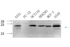Western Blotting (WB) image for anti-Caveolin 1, Caveolae Protein, 22kDa (CAV1) antibody (ABIN5960477) (Caveolin-1 anticorps)