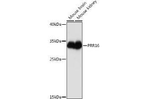 Western blot analysis of extracts of various cell lines, using PRR16 Rabbit pAb (ABIN7269554) at 1:1000 dilution.