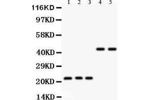 Anti- GPX1 antibody, Western blotting All lanes: Anti GPX1  at 0. (Glutathione Peroxidase 1 anticorps  (Middle Region))