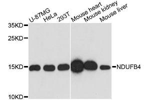 Western blot analysis of extracts of various cell lines, using NDUFB4 antibody.