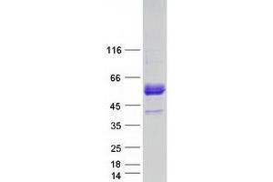 Validation with Western Blot