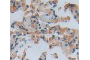 IHC-P analysis of Human Tissue, with DAB staining. (Vitronectin anticorps  (AA 19-111))