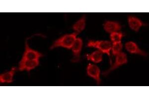 ABIN6268739 staining HeLa by IF/ICC. (Cathepsin D anticorps  (C-Term))