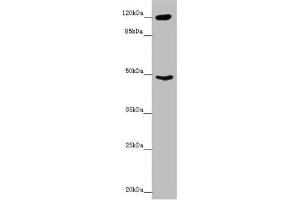 Western blot All lanes: INPP4A antibody at 8. (INPP4A anticorps  (AA 1-250))