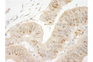 Immunohistochemistry (IHC) image for anti-RAN Binding Protein 1 (RANBP1) (AA 1-50) antibody (ABIN7449008) (RANBP1 anticorps  (AA 1-50))