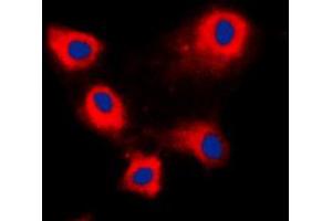 Immunofluorescent analysis of ARFIP1 staining in HeLa cells. (ARFIP1 anticorps  (C-Term))