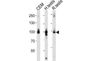 Western blot analysis of lysates from CEM cell line, human testis, rat testis tissue lysate (from left to right), using AC Antibody (C-term) 1151a.