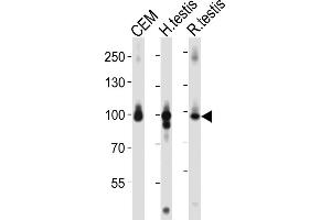 Western blot analysis of lysates from CEM cell line, human testis, rat testis tissue lysate (from left to right), using AC Antibody (C-term) 1151a. (Centaurin beta 2 anticorps  (C-Term))
