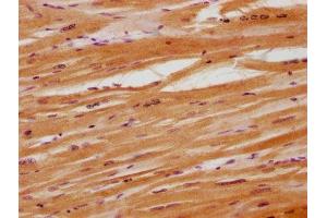 IHC image of ABIN7160584 diluted at 1:100 and staining in paraffin-embedded human heart tissue performed on a Leica BondTM system. (MYH6 anticorps  (AA 894-1132))